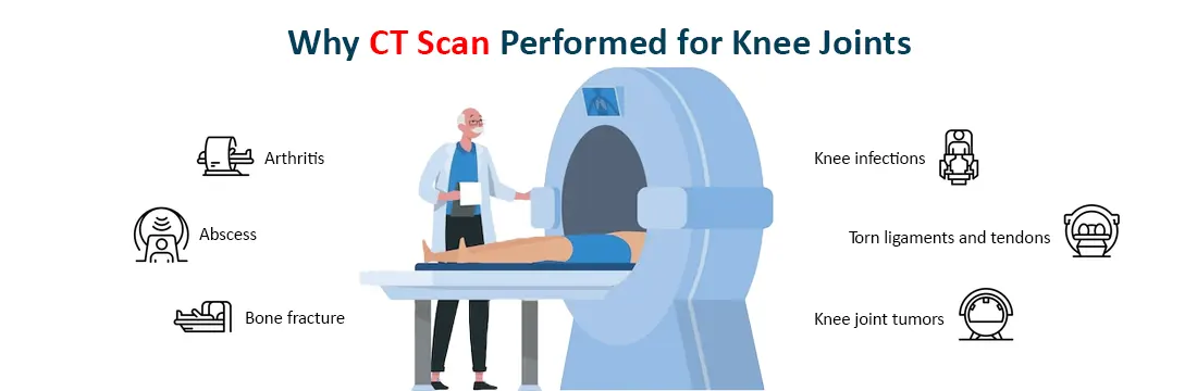 CT Scan Performed for Knee Joints